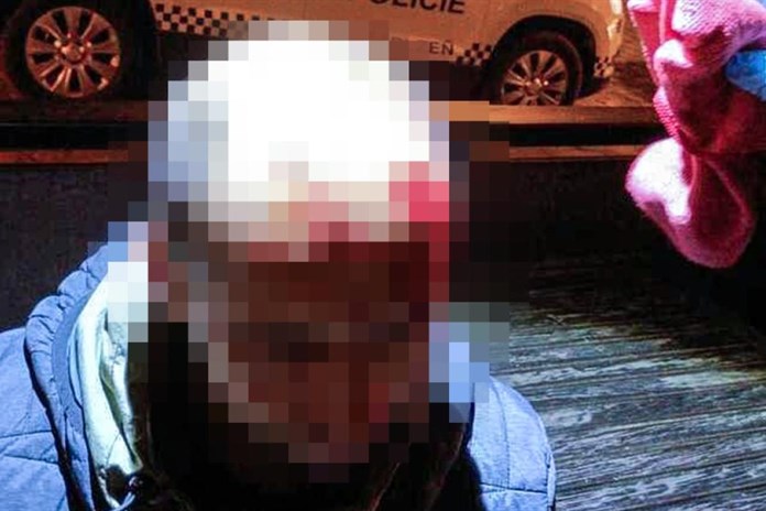 Strážníci v Plzni zachránili krvácejícího muže v Kopeckého sadech